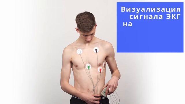 Normocard - уникальное профессиональное облачное решение системы холтеровского мониторирования ЭКГ. смотреть онлайн