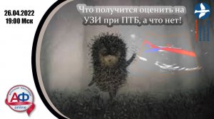 Что получится оценить на УЗИ при ПТБ, а что нет!