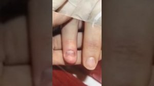 Восстанавливаем поврежденную ногтевую пластину! Лосьон Strong от SAGITTA реально работает!!!