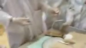 Катетеризация мочевого пузыря