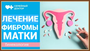 ЛЕЧЕНИЕ ФИБРОМЫ МАТКИ