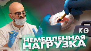 Что такое немедленная нагрузка?