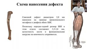 ВЛИЯНИЕ ПРИЕМА ПРЕПАРАТА КАЛЬЦИЯ КАЛЬЦЕМИН АДВАНС НА РОСТ БОЛЬШЕБЕРЦОВОЙ КОСТИ У КРЫС С СД 2 ТИПА