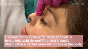 Nonsurgical Nose Job Temporarily Reshapes Nose