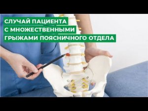 Множественные грыжи поясничного отдела позвоночника. Случай пациента.