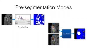 RSNA 2016 ITK-SNAP Training - Automatic Segmentation