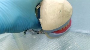 съёмное протезирование