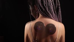 Массаж при болях в шее. Применение динамических вакуумных банок AchedAway Cuppers.