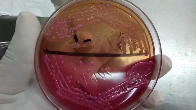Klebsiella pneumoniae and Acinetobacter Colony characteristics on Macconkey medium Demonstration смотреть онлайн