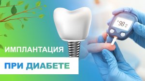 ⚡ Имплантация зубов при сахарном диабете