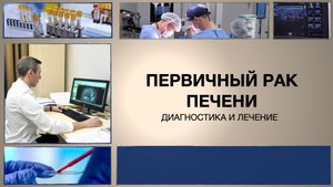 Первичный рак печени.