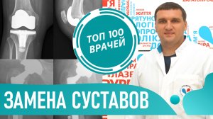 Лечение артроза. Замена коленного и тазобедренного сустава. Эндопротезирование и реабилитация