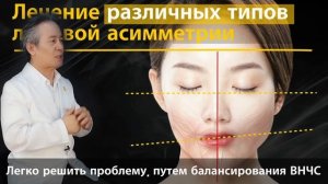 Для чего нужно исправлять лицевую асимметрию?