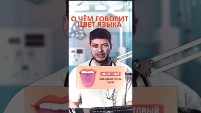 О чём говорит цвет языка?