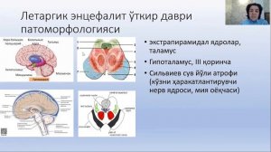 Расулова Д.К Бош мия яллиғланиш касалликлари.Менингитлар давоми ва Энцефалитлар.