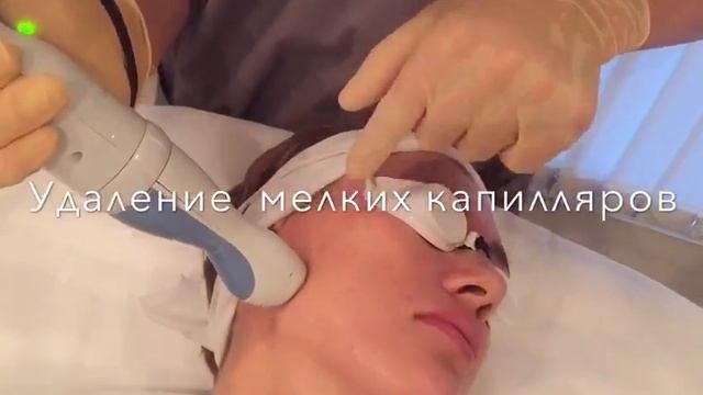 Лазерная шлифовка и фотоомоложение в одну процедуру