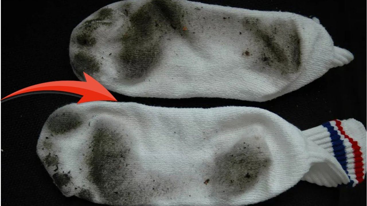 Почему пахнут носки