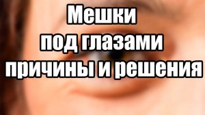 Мешки под глазами: причины и решения. Убрать мешки под глазами.