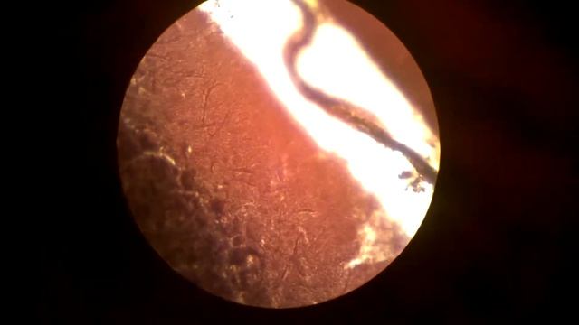 Cerebellum. Purkinje cells. Мозжечок. Клетки Пуркинье