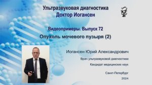 Ультразвуковая диагностика. Доктор Иогансен. Видеопримеры. Выпуск 72. Опухоль мочевого пузыря (2).