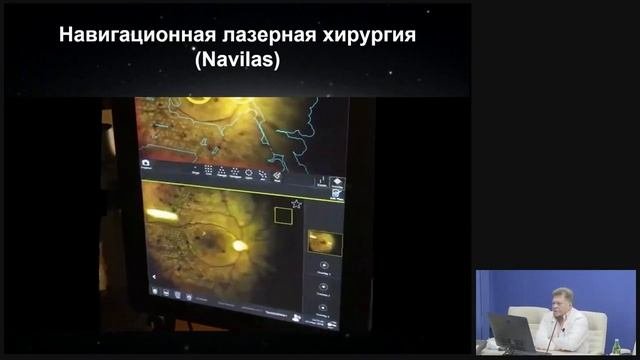 Инновационная офтальмология. Мечты и реальность.mp4