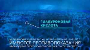 Артелак Всплеск раствор для глаз