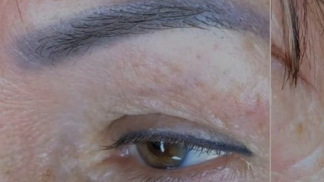 Перекрытие старого татуажа с изменением формы | Возрастная кожа смотреть онлайн