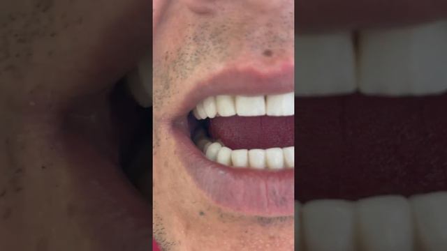 Здоровые зубы, красивая улыбка :) смотреть онлайн