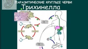 трихинелла