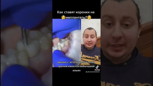 Как ставят коронки на импланты?🤔🦷 #дантист #стоматолог #стоматология #импланты #имплант #имплантаты