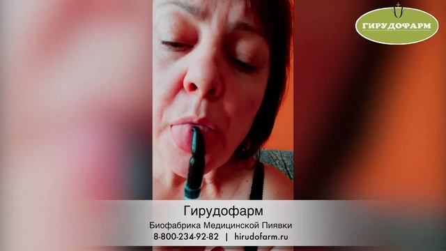 Постановка пиявки на язык , поцелуй с пиявкой