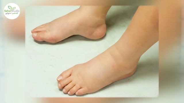 Peshab Bar Bar Ana: Masana Ki Kamzori Ki Wajohat Alamat Ilaj, Frequent Urination, Overactive Bladde