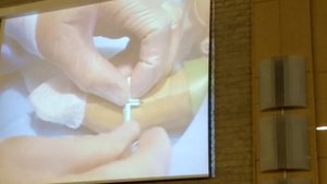 Катетеризация центральных вен у новорожденных. Vygon.