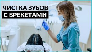 Гигиена брекет-системы. Профессиональная чистка зубов