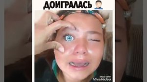 Шок! У девочки выпал глаз