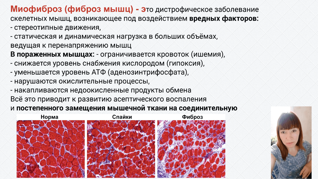 Фиброз что это за болезнь симптомы и лечение у мужчин фото