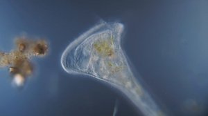 Инфузория трубач под микроскопом.