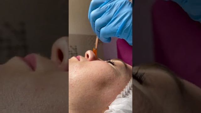 Комплексная чистка лица Стогино смотреть онлайн