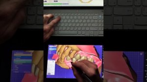 Интерактивный дисплей XPPen для зубных техников