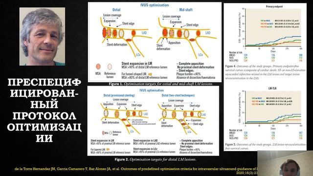 Лекция   Стентирование ствола ЛКА смотреть онлайн