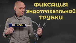 Методы фиксации эндотрахеальной трубки.  #ПроСМП