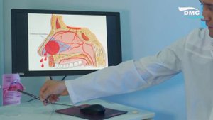 Burundan qon ketishi sabablari