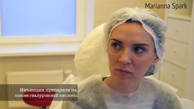 Как убрать ТЕМНЫЕ (СИНИЕ) КРУГИ под глазами?! ?️?️ Коррекция филлерами. Макс Адам Шерер