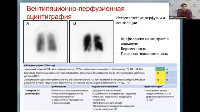 Тромбоэмболия легочной артерии Зюряев И.Т. смотреть онлайн