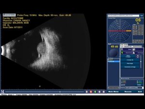 Ультразвуковой сканер B-Scan (Б-скан) plus