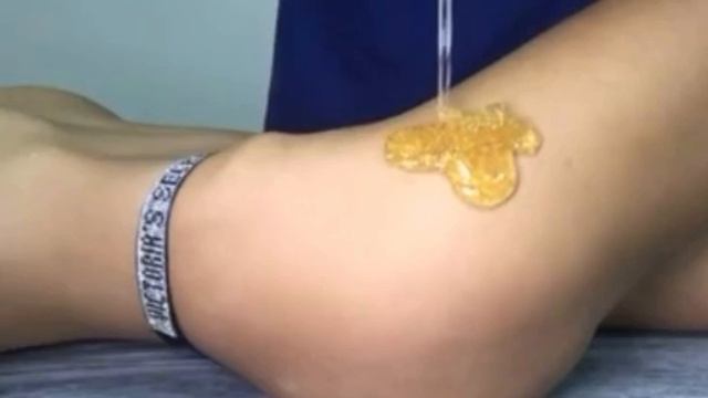 карамельная липосакция