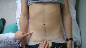 Проекция паховой связки