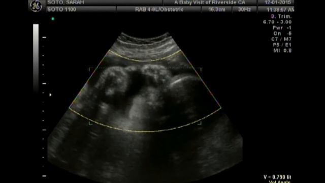 ßlå¢ký104 - Aluna Lavender Bruce 4D Ultrasound – 12/01/2015 смотреть онлайн