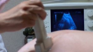 ВАЖНЫЕ ПАРАМЕТРЫ ПЛОДА НА УЗИ | Норма и расшифровка УЗИ во время беременности