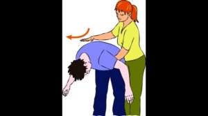 Первая помощь при попадании инородного тела в верхние дыхательные пути